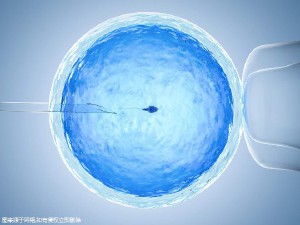 第三代试管婴儿 PGT